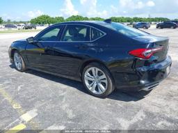 2021 ACURA TLX TECHNOLOGY PACKAGE Black  Gasoline 19UUB5F40MA012749 photo #4